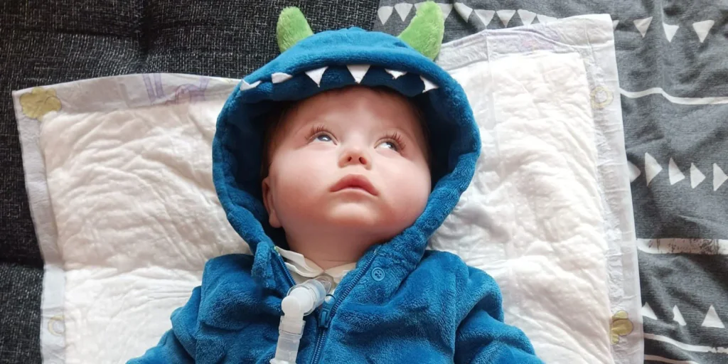 Případ, jaký tu lékaři nečekali. Jiříkova nemoc je tak vzácná, že nemá jasnou léčbu.