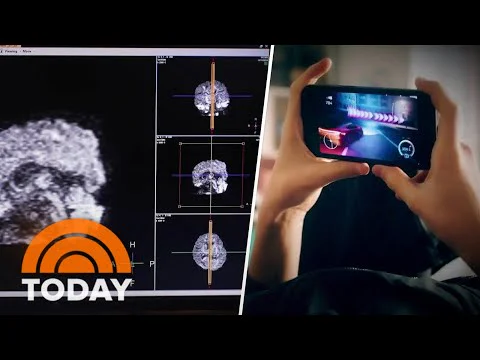 Video k článku ZDE