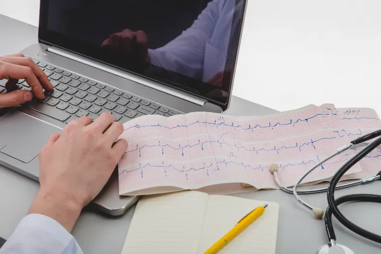 ekg