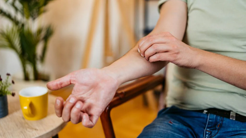 Generalizované svědění