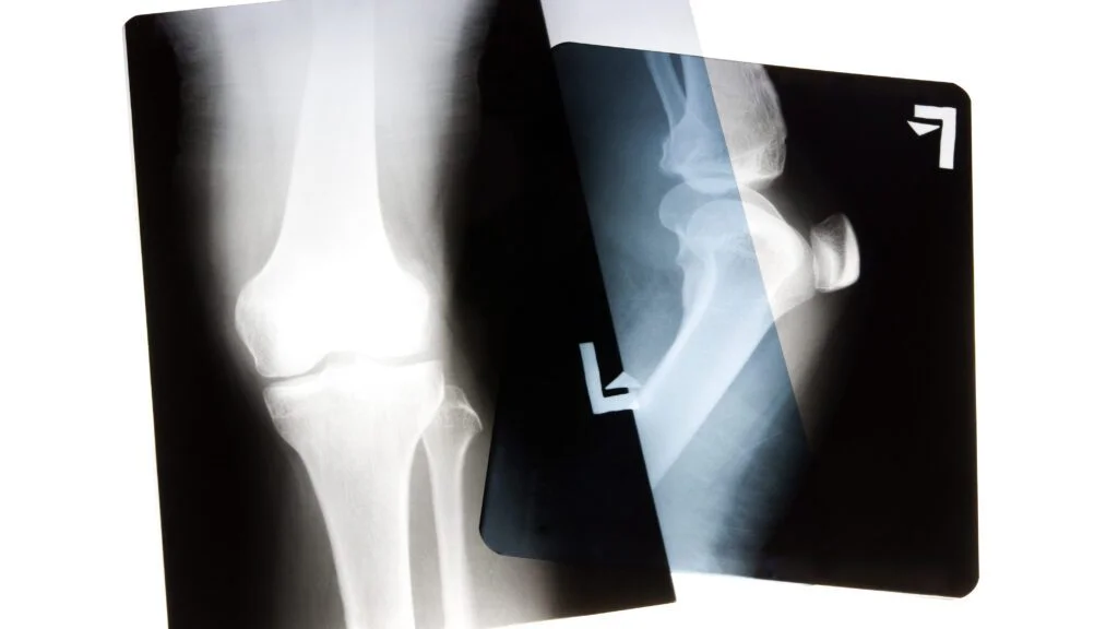 Záhadné světlo v laboratoři