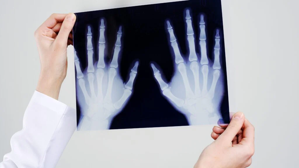 Praktické použití 