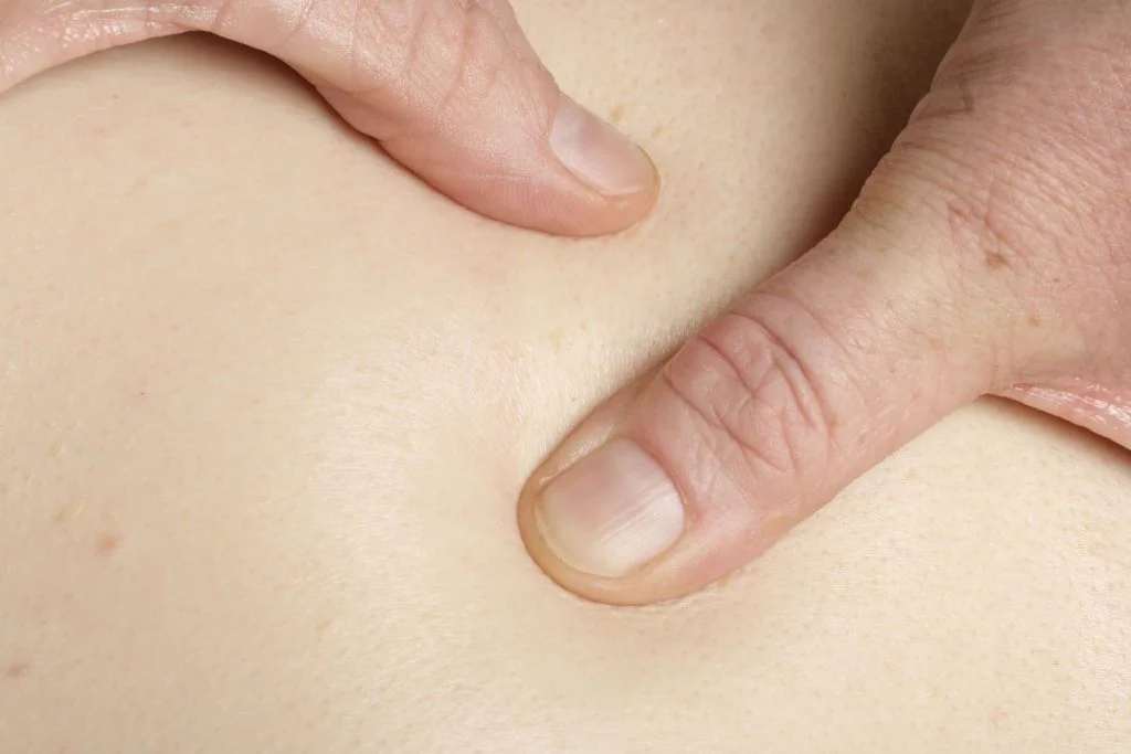 možná bulka pod kůží