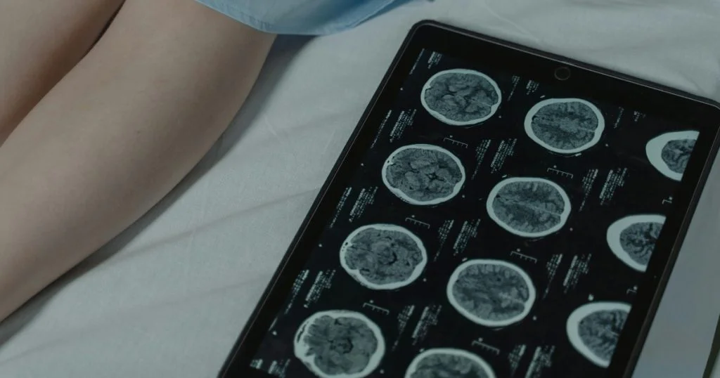 Žena na lůžku a snímek