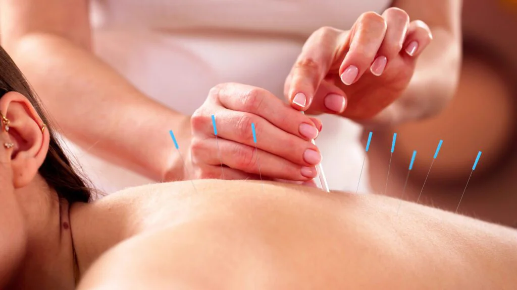 Jak akupunktura funguje?