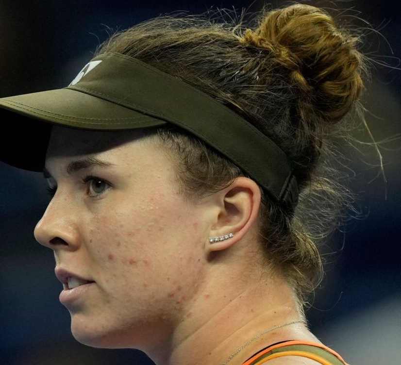 Máš komplex bílého spasitele, nařkl Noskovou Španěl. Češka se hájila vtipem