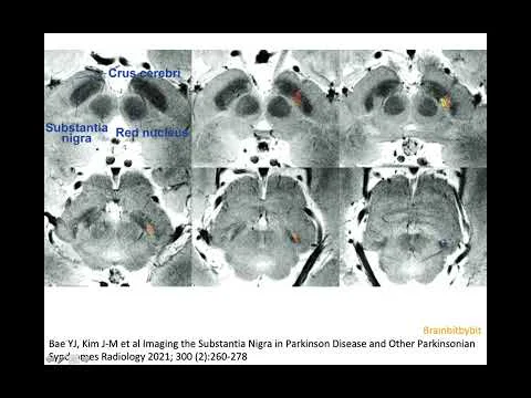 Video k článku ZDE