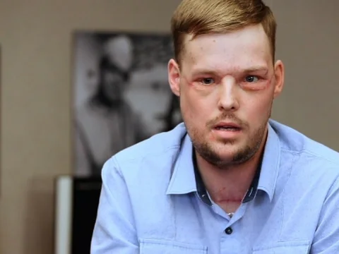 Video k článku ZDE