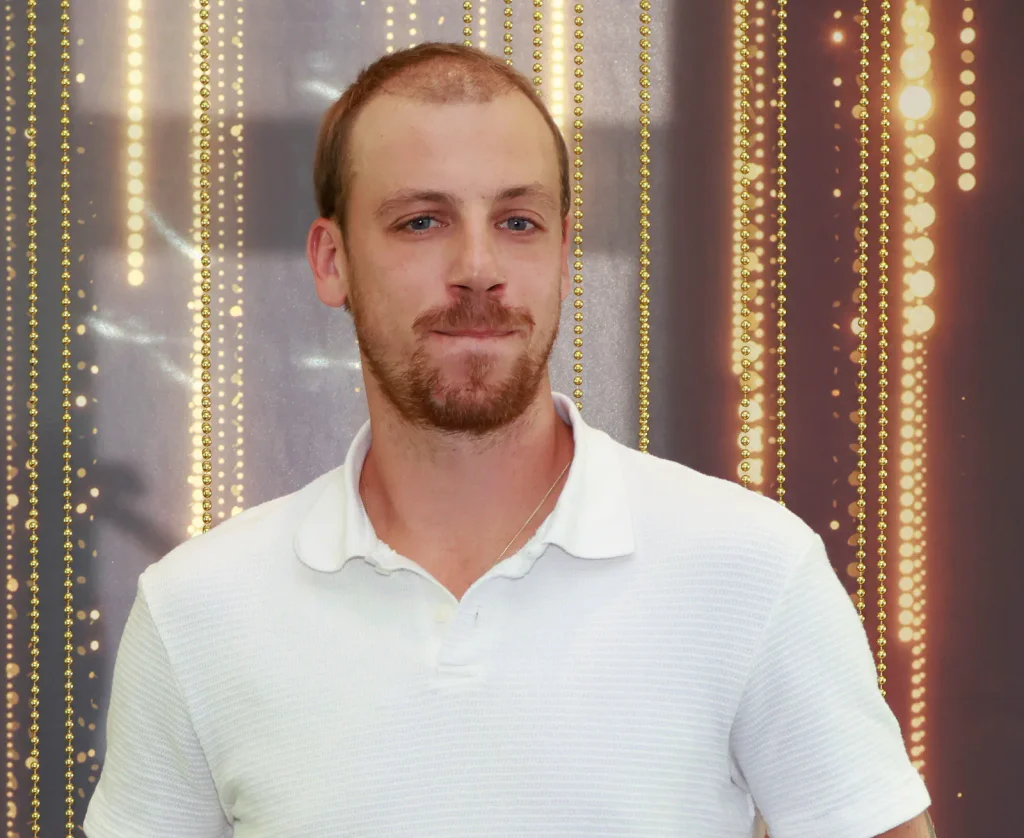 Prágr se ukázal po estetickém zákroku. Jeho nový vzhled rozpoutal bouřlivé komentáře.