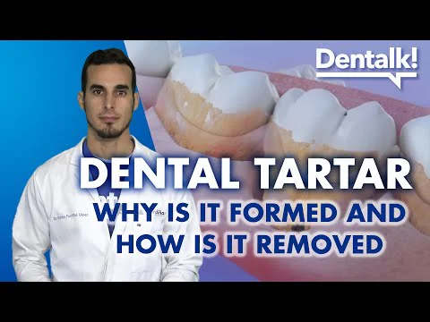 Video k článku ZDE