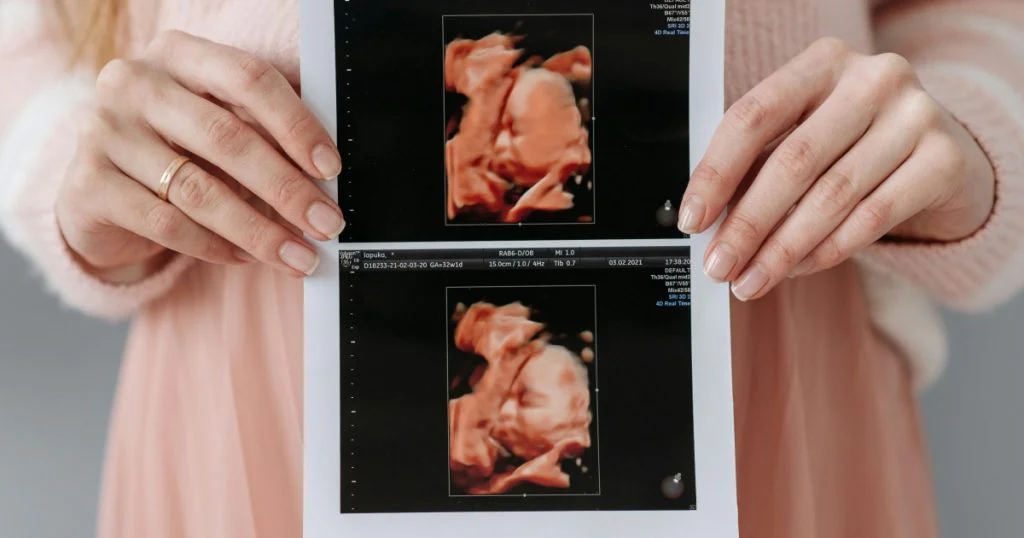 Obrázek ze sonografu