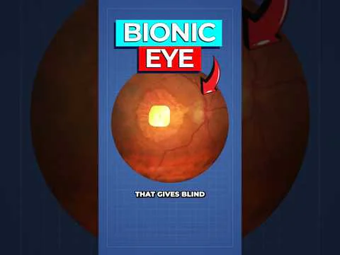 Video k článku ZDE